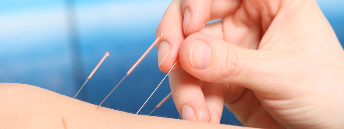 acupuncturist near me